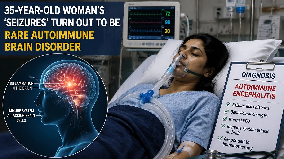 Thane: 35-Year-Old Woman’s ‘Seizures’ Diagnosed As Rare Autoimmune Encephalitis At KIMS Hospitals