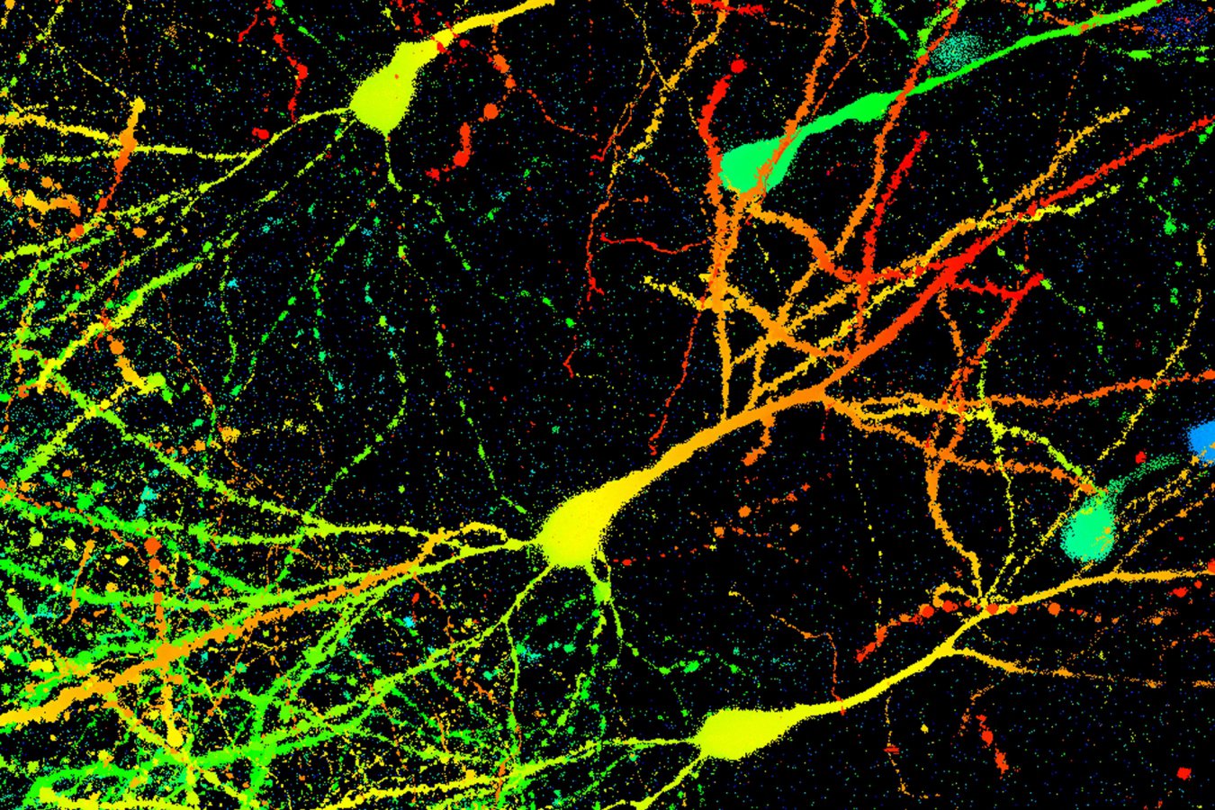 ‘Remarkable’ discovery upends our understanding of how brains store memories
