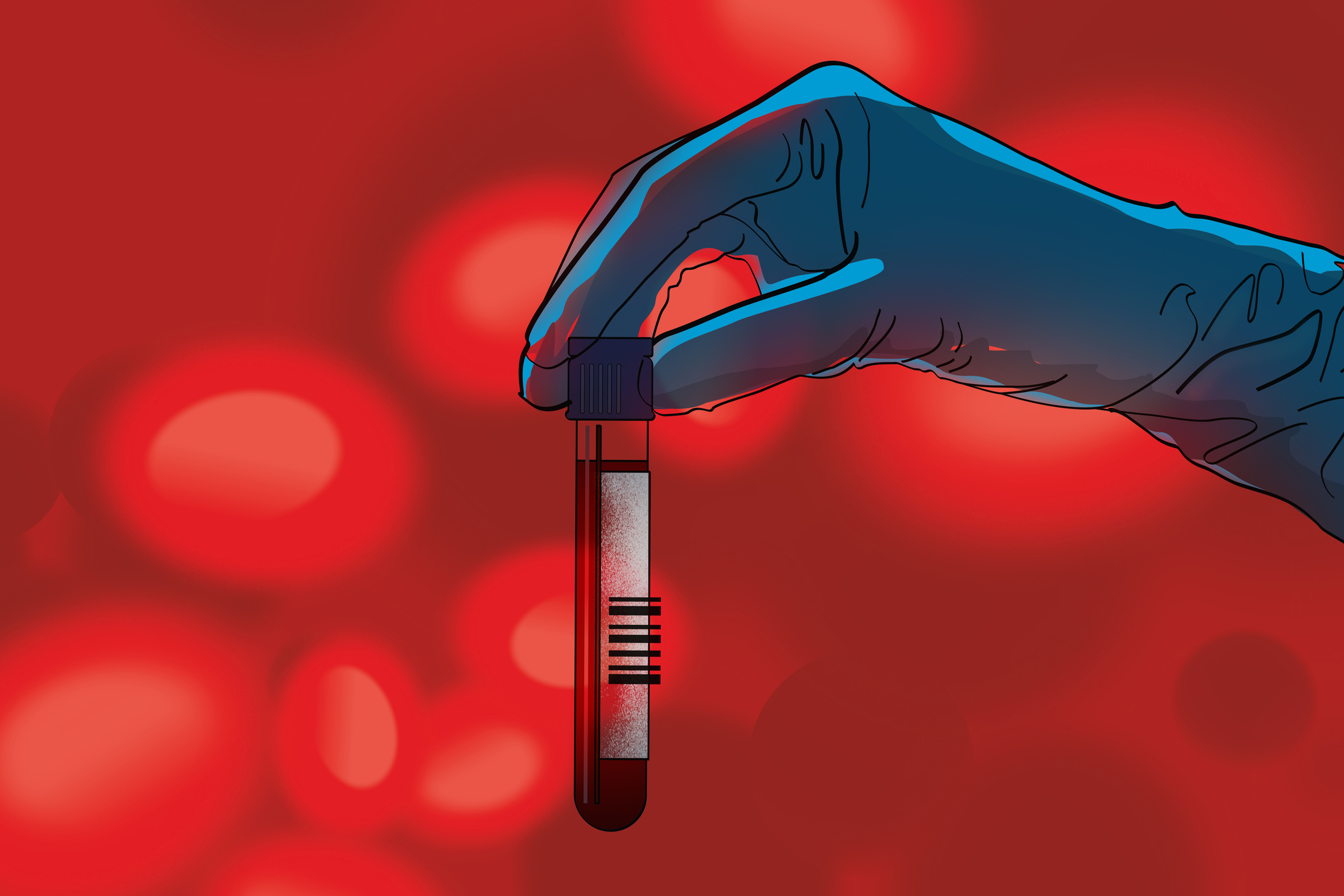 Why the U.S. Urgently Needs More Platelet Donors