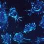 Scientists uncover 'hidden switch' that helps cancer cells hide from the immune system