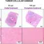 Intermediate histotripsy dose boosts tumor regression in liver cancer model