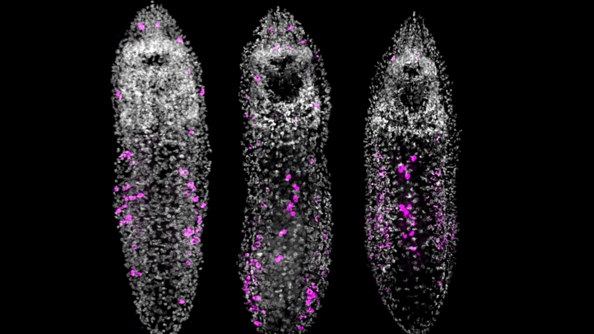 Scientists Overfed a Tiny Worm… And It Started Growing a Chain of Clones