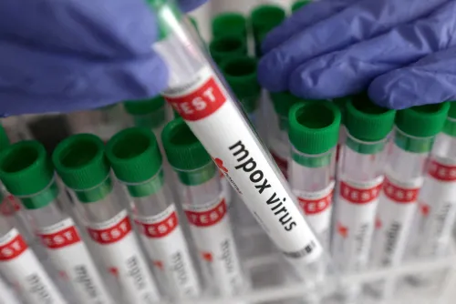 Mpox alert: Western Cape traces contacts after cases linked to two gatherings