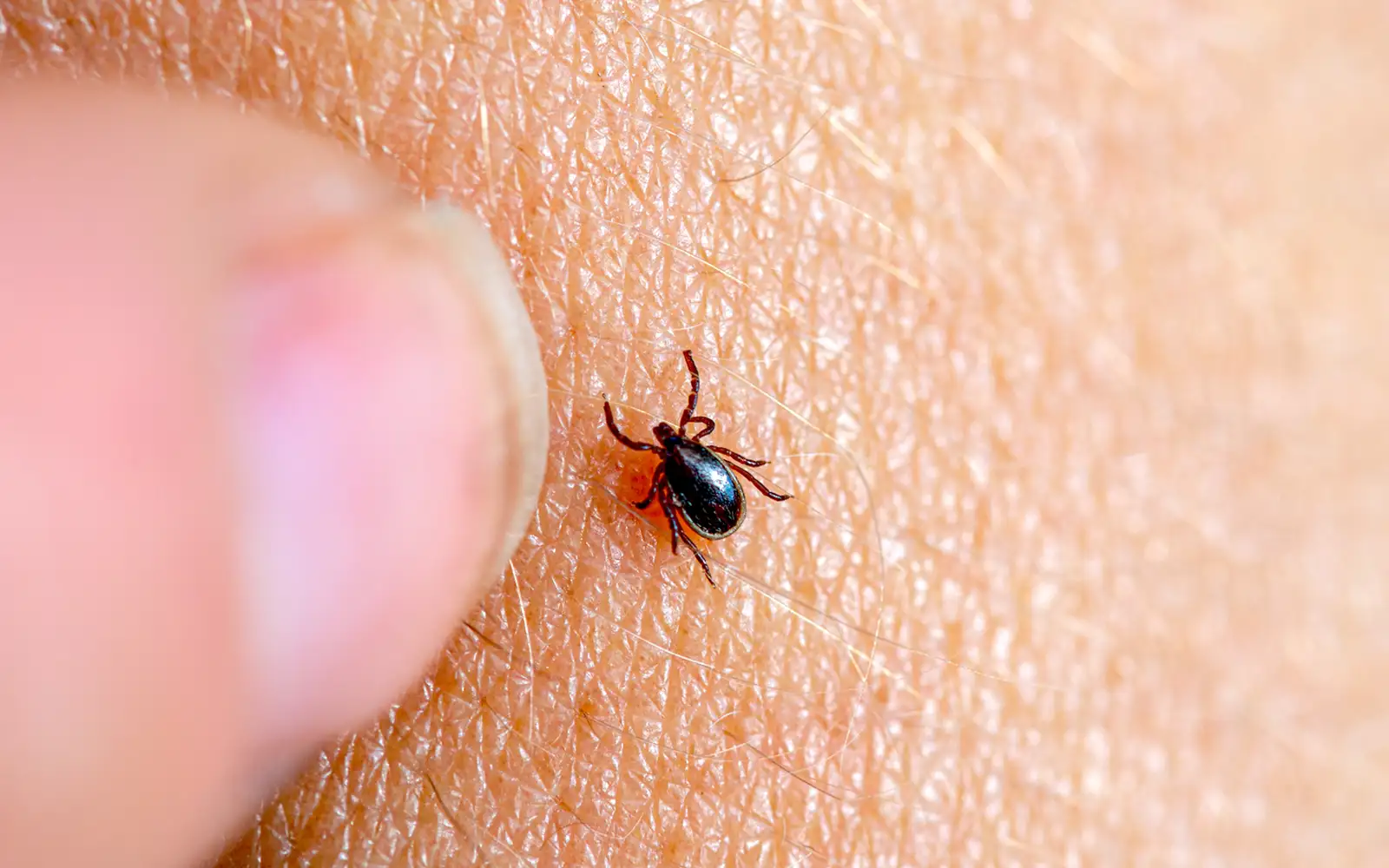 EU to study potential vaccine for Lyme disease