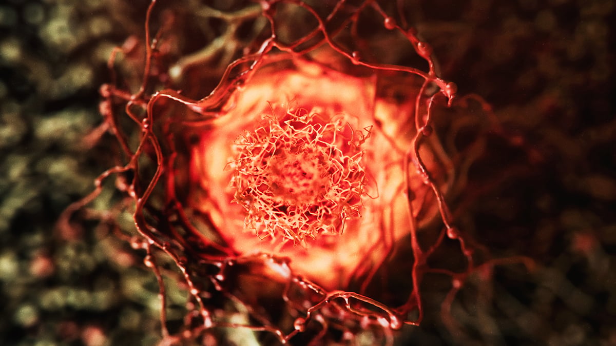This Drug Wiped Out All Cancer Markers in 78% of High-Risk Patients – Before They Even Got Cancer