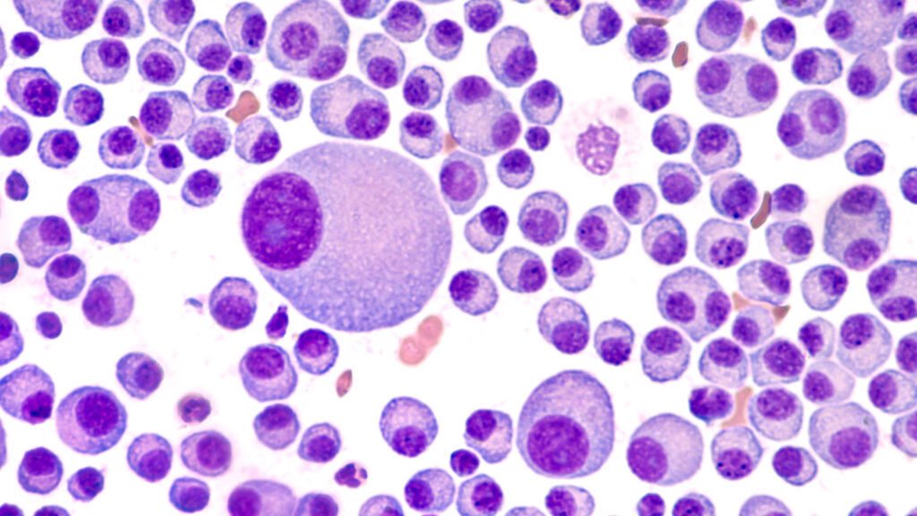 STAT+: FDA approves Bristol multiple myeloma treatment, marking debut of novel drug class