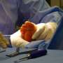 New tool enables early intervention for diabetes related foot ulcers