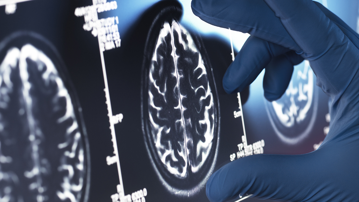 Depression May Affect Two Key Brain Regions – But Change Is Not Inevitable