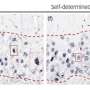 Researchers identify possible marker of suicidal thoughts