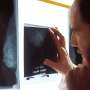 Breast cancers can recruit bone cells to increase tumor growth