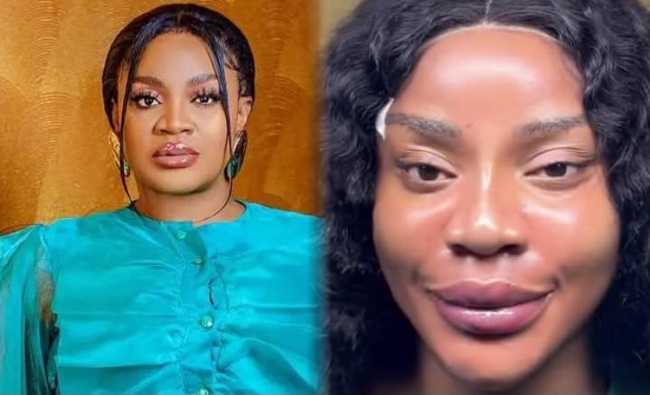 ‘I don’t like how I look’ – Uche Ogbodo after facial transformation