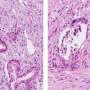 Selenite changes key properties of pancreatic cancer cells in experimental models