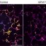 Platelet-targeting approach offers a new path to safer thrombosis protection