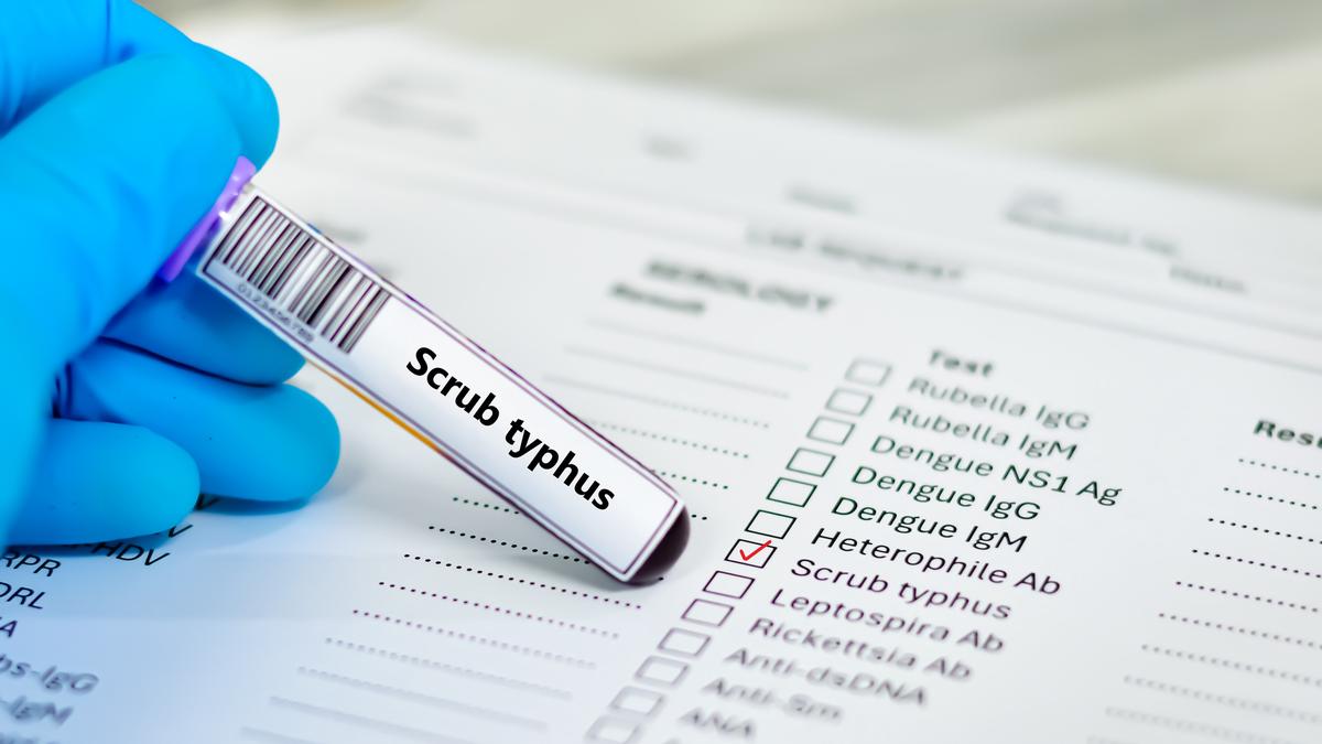 What is scrub typhus | Explained