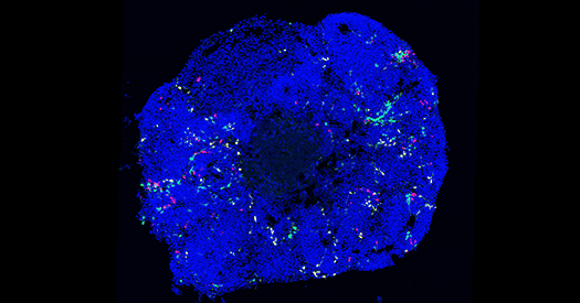 Hasty stem cells highlight potential limitation with cortical organoids