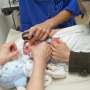 Cortisone eyedrops could save the sight of extremely premature babies