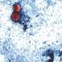 Michigan reports first 2 US deaths in outbreak of cyclospora