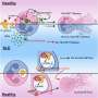 Lupus-linked immune misdirection could leave patients vulnerable to staph infections
