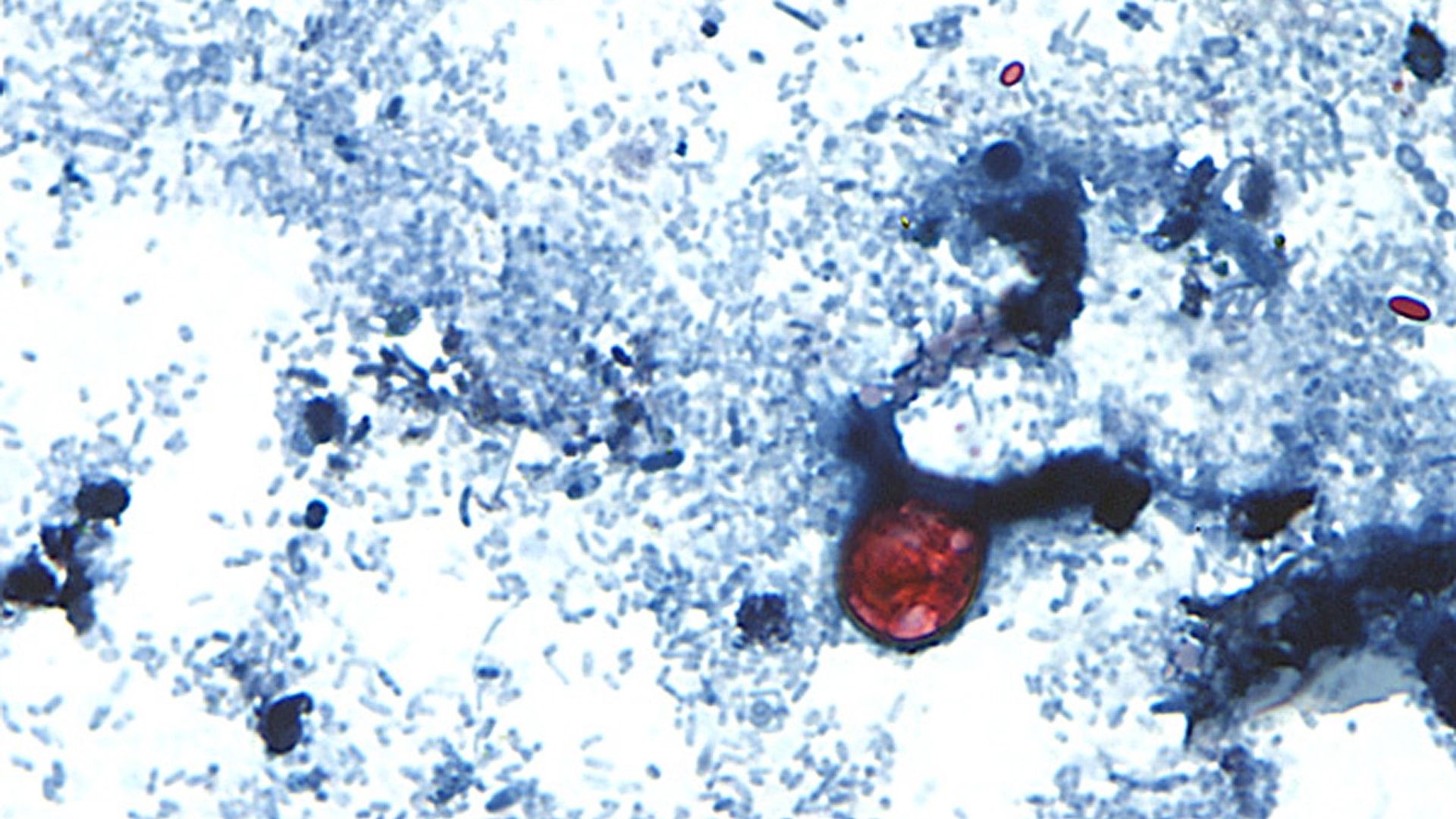 Two die as cases of 'explosive diarrhoea' infection surge in US state